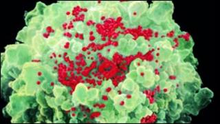An HIV-infected immune cell