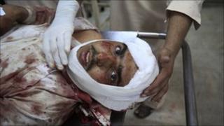 Victim of the bomb attack at a mosque in Darra Adam Khel is taken to Lady Reading Hospital in Peshawar for treatment November 5, 2010.