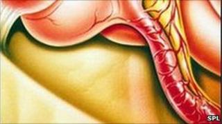 Appendix