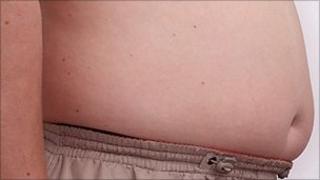 Overweight patient