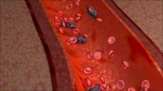 Blood infection