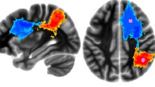 Brain scans of fighter pilots