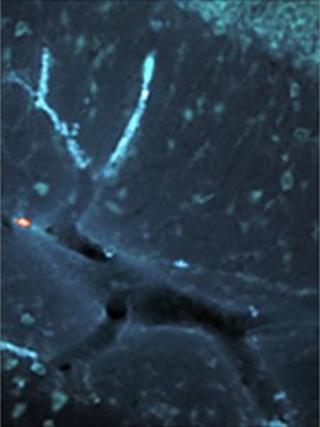 Rudolph the red-nosed blood vessel