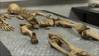 skeleton