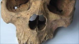 Skull of an African man discovered in Warwickshire.