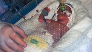 Baby Bailey in hospital