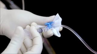 chemotherapy