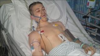 Michael Stevenson, who was stabbed in Sale