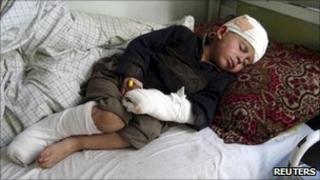 A boy, injured during a NATO air strike, lies on a hospital bed in Afghanistan"s eastern Kunar province