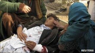 A mother touches her wounded son after a suicide attack in Emam Saheb district of Kunduz province February 21, 2011