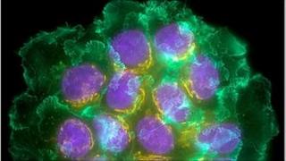 Breast Cancer Cells