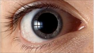 Eye