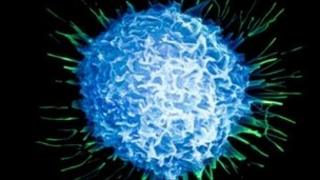 Prostate cancer cell