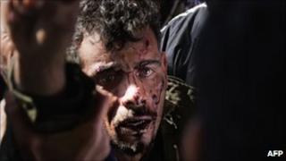 A wounded rebel is brought to Ras Lanuf hospital after fighting in Bin Jawad - 6 March 2011