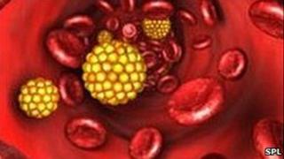 Cholesterol