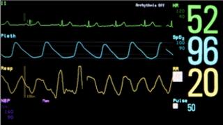 Vital signs monitor
