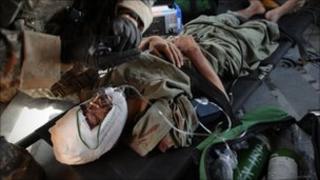 A wounded Afghan civilian lies on the floor of a Blackhawk helicopter from Company C, 1st Battalion, 52nd Aviation Regiment, MEDEVAC team over the southern Kandahar province on March 28, 2011.
