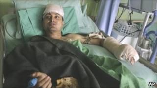 Gokarna Bista in hospital