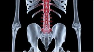 x-ray
