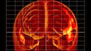 Language brain centres during MRI
