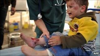 A Libyan boy is treated after being wounded by shelling in Misrata - 25 April 2011