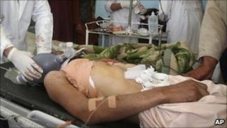An Afghan policeman is treated by doctors after being wounded in a gunfight with militants in Ghazni - 1 May 2011