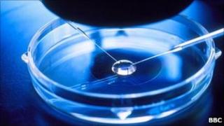 Capture of fertile sperm by Computer Imaging Sperm Selection, a step in process of in vitro fertilisation