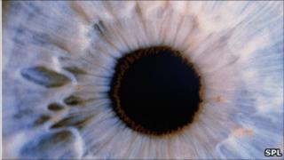 Eye