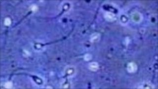 Sperm