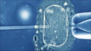 IVF treatment