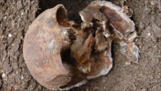 The skull of Julia Martha Thomas, found in Richmond last October