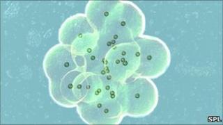 In vitro fertilisation 01/03/2009 Science Photo Library