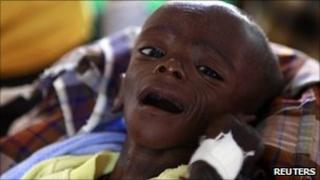 Minhaj Gedi Farahi undergoes treatment at the Dadaab refugee camp, Kenya