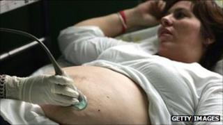 A woman getting a sonogram