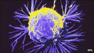 Breast cancer cell