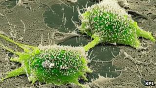 Dividing cancer cell