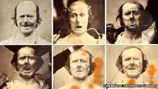 Photographs taken by Benjamin Duchenne