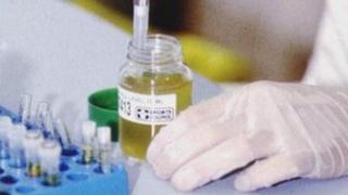 Laboratory technician, testing a urine sample