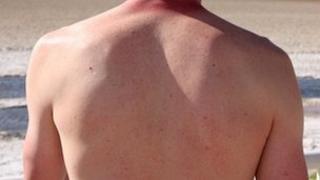 Man's back