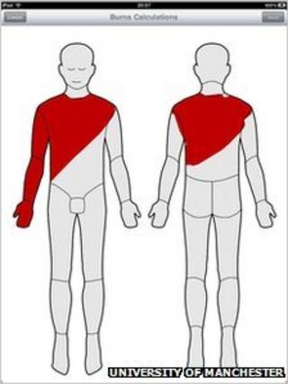 Images from the Mersey Burns app