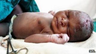 Newborn with cord clamped