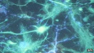 Brain cells
