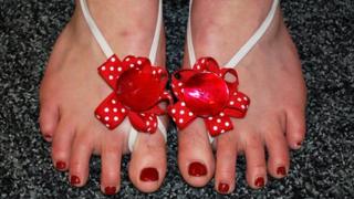 Bea Marshall wearing her "fake shoes"