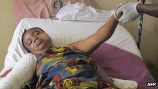 An Unidentified victim of the Christmas day bomb explosion at St. Theresa Catholic Church in Madalla, receives treatment at the University of Abuja teaching hospital Gwagwalada in Abuja , Nigeria, Thursday, Dec. 29, 2011