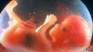 14-week-old foetus