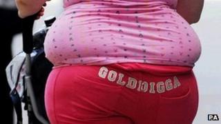 Obese person