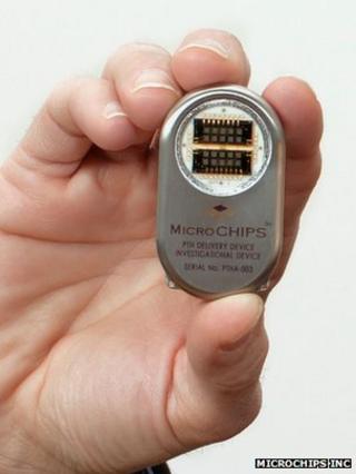 Implant device