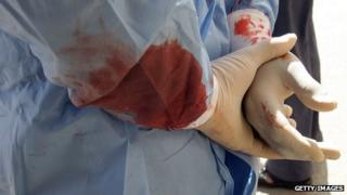 A medic stands in bloodstained robes after treating people at a hospital in Deraa, south of the capital Damascus