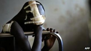 Victim of LRA in Uganda (file photo)