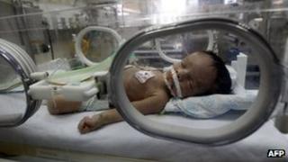 A baby in a neo-natal intensive care unit in Gaza City (27 March 2012)